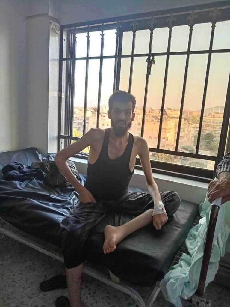Rights Monitor Syria Demands an Independent Investigation into the Circumstances Surrounding the Death of Young Man Abd Al-Salam Abd Al-Hakim Akko Following His Release from Hama Central Prison